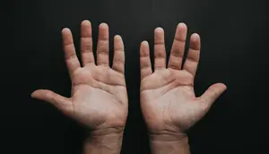 Bangun Tidur Tangan Kaku dan Bengkak? Bisa Jadi Tanda Rheumatoid Arthritis