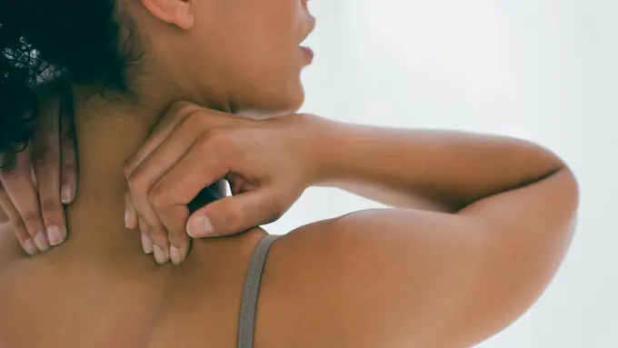 Ini Penyebab dan Cara Menghilangkan Jerawat di Punggung