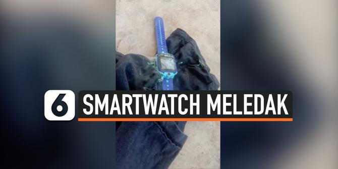 VIDEO: Detik-Detik Smartwatch Anak Meledak dan Keluarkan Asap