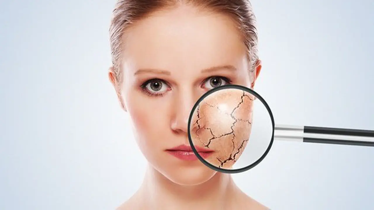 Kulit kering akan membuat wajah tampak kusam/copyright: thinkstockphotos.com