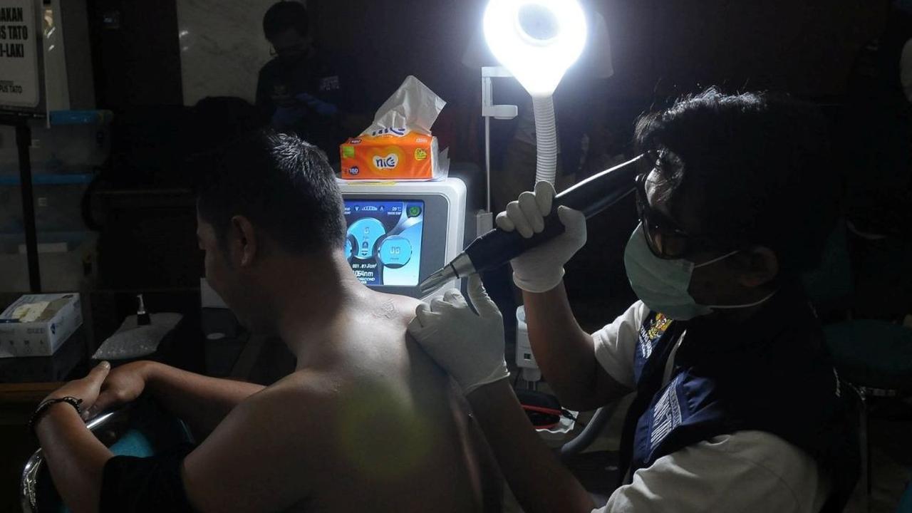Petugas Baznas DKI Jakarta membersihkan tato warga di Kantor Walikota Jakarta Timur, Rabu (20/3/2024). Layanan hapus tato yang diadakan oleh Baznas ini gratis bagi warga yang ingin membersihkan diri dari tato. Foto: merdeka.com / Imam Buhori