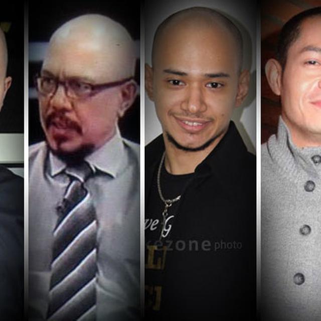 Walau Botak Artis Artis Ini Tetap Ganteng News Entertainment Fimela Com