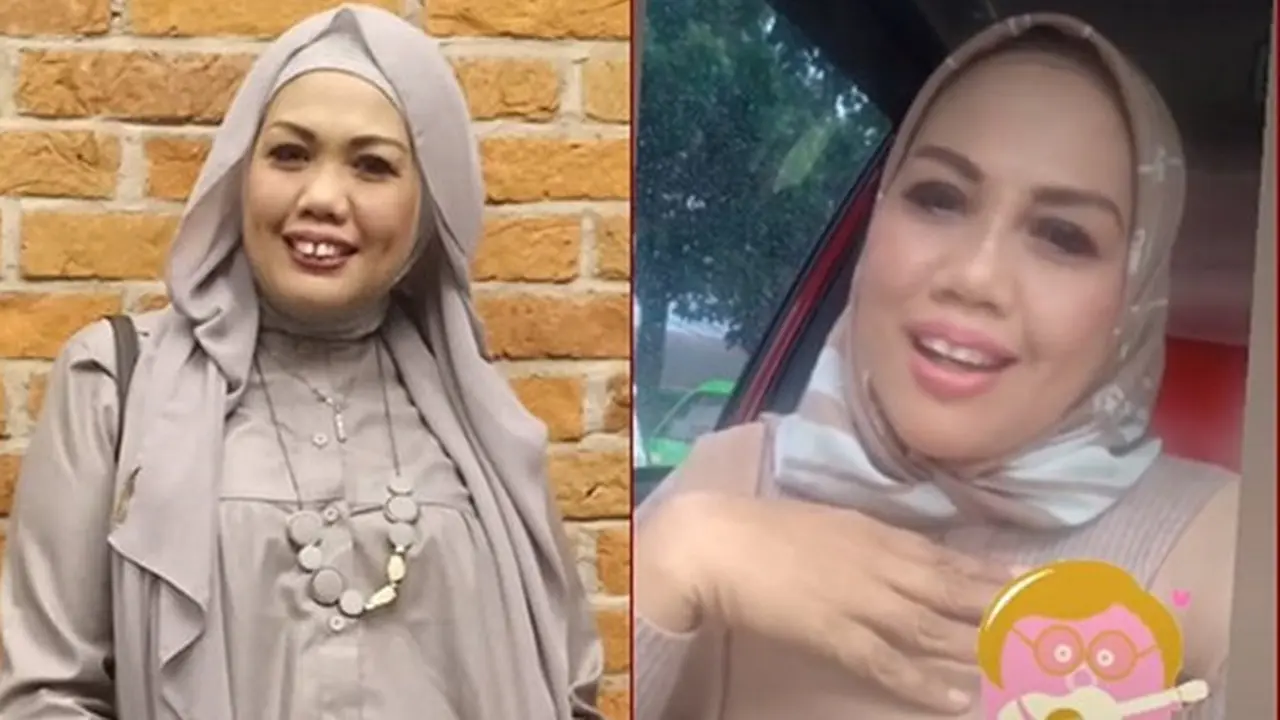 6 Transformasi Seleb Setelah Perbaikan Gigi, Terbaru Elly Sugigi