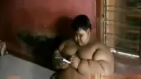 Bocah obesitas, Arya Permana didatangi petugas Puskesmas di kediamannya di Tegalwaru, Karawang, Jawa Barat untuk pemeriksaan. 