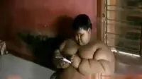 Diet Sehari Bobot Bocah Arya Turun Jadi 188,4 Kg