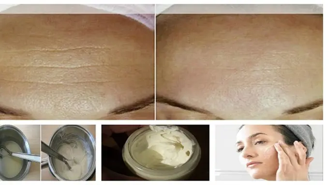 Kurang dari Dua Minggu Keriput Wajah Hilang, Mau?