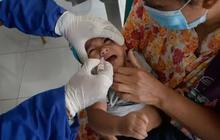 Dokter Anak Tegaskan Imunisasi Polio Aman untuk Anak Berkebutuhan Khusus Termasuk Autisme