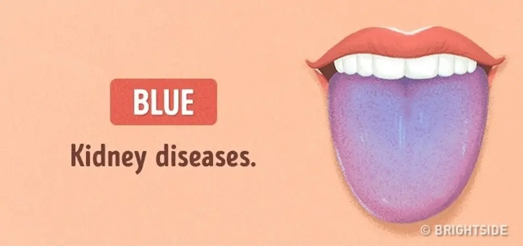 Penyakit ginjal. (Sumber foto: brightside.me)