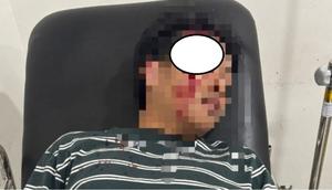 Anak purnawirawan Polri aniaya pegawai bank. (Istimewa)