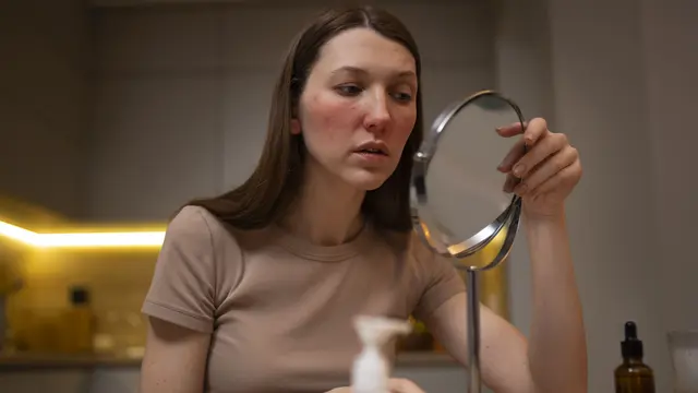 Ilustrasi kulit terbakar