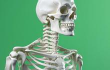 Jangan Abaikan! Osteoporosis Bisa Dicegah Jika Dikenali dari Awal