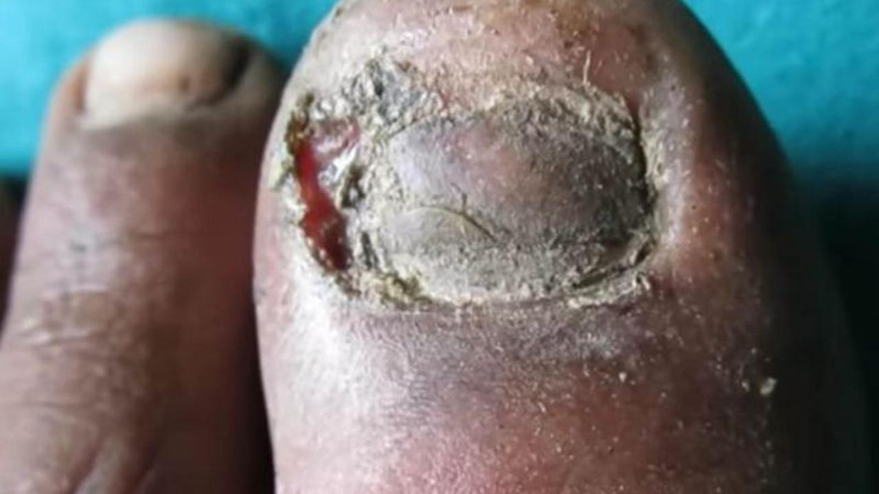 Lihat Kuku Jorok Ini Bikin Bergidik