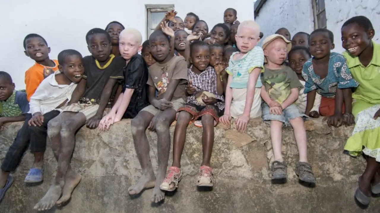 Kisah Anak Albino di Melawi yang Diburu dan Hampir 'Punah'