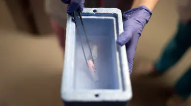 Seorang petugas medis menunjukkan sampel sperma dalam tabung yang disimpan dalam nitrogen cair di klinik kesuburan IVMED di Kyiv, Ukraina, 31 Januari 2023. Beberapa tentara Ukraina beralih ke proses pembekuan sperma karena menghadapi kemungkinan mereka tidak akan pernah pulang. (AP Photo/Roman Hrytsyna)