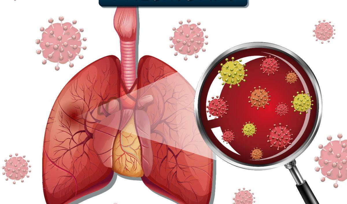 12. Obat Alternatif Pneumonia