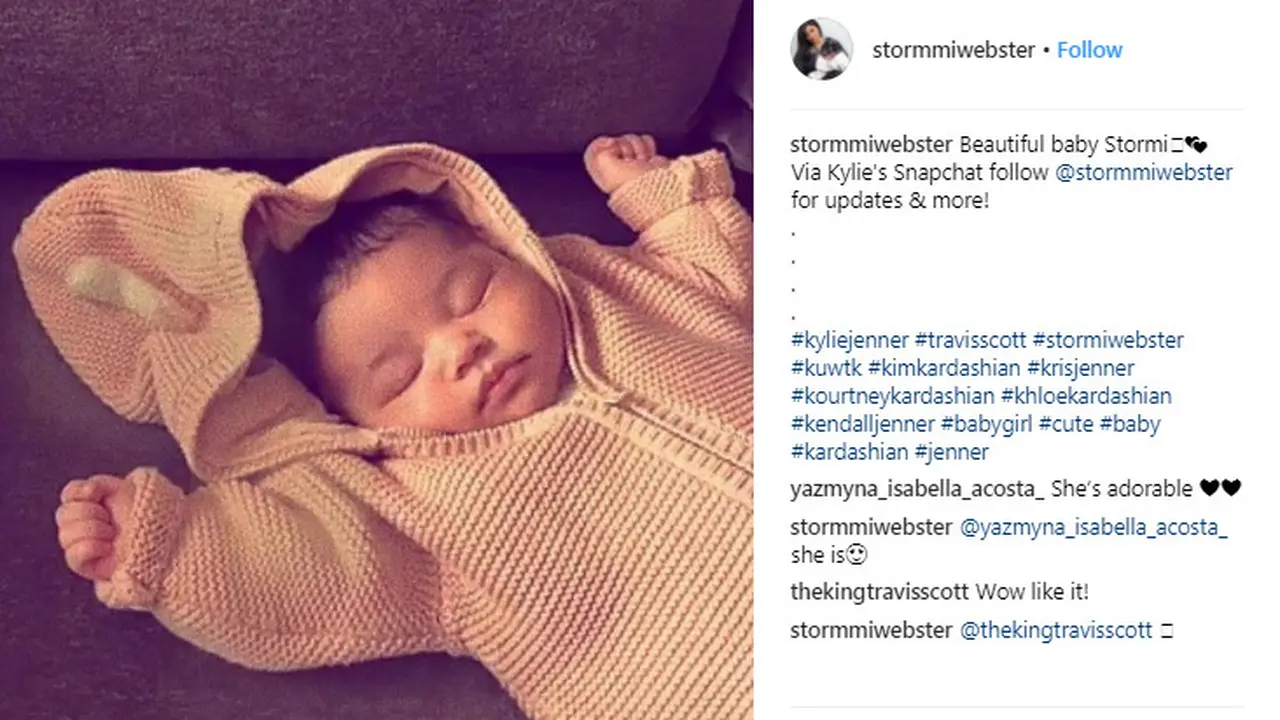Bibir Seksi Stormi Webster, Calon Model Kylie Cosmetics?