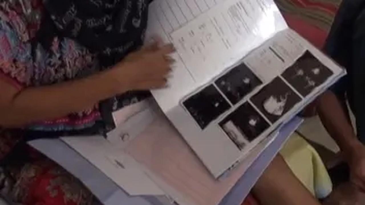 Sakit Jantung, Pasien RS Abdul Manaf Malah Kakinya Diamputasi Diduga Malpraktek