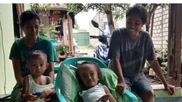 Bocah penderita hidrosefalus