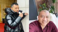 Jalani Transplantasi Rambut, Ini 6 Potret Terbaru Anang Hermansyah dengan Kepala Botak (Sumber:Instagram/ananghijau)