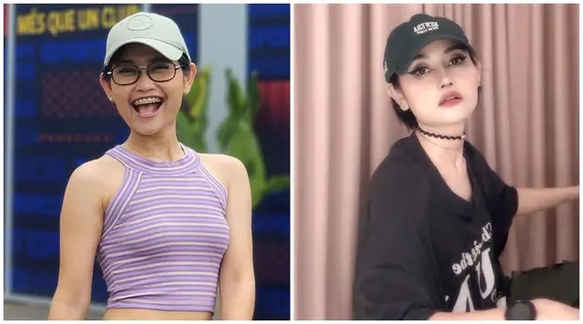 6 Potret Riyuka Bunga Sebelum dan Sesudah Oplas Hidung, Dulu Dipanggil Pesek