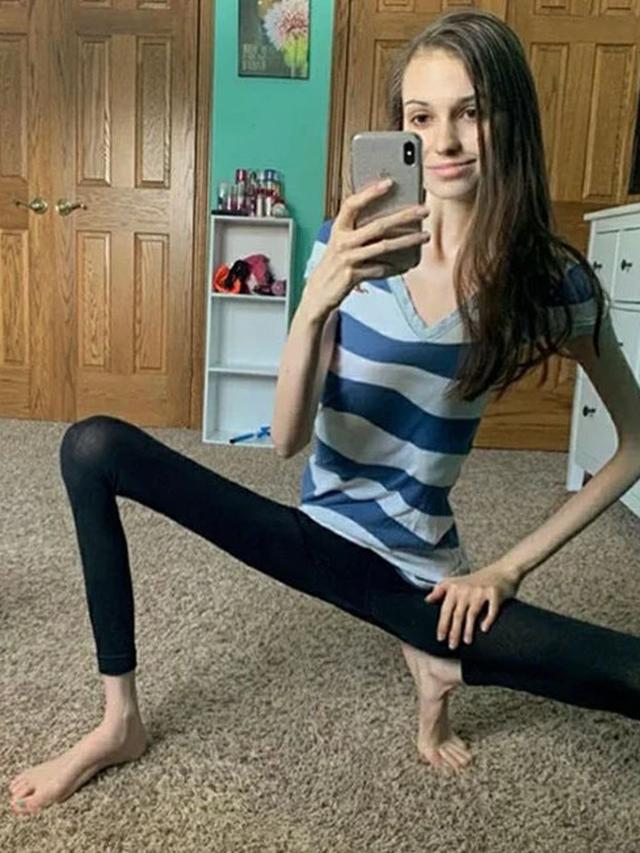 Biking Geleng Kepala, 8 Potret yang Diedit Berlebihan di Instagram