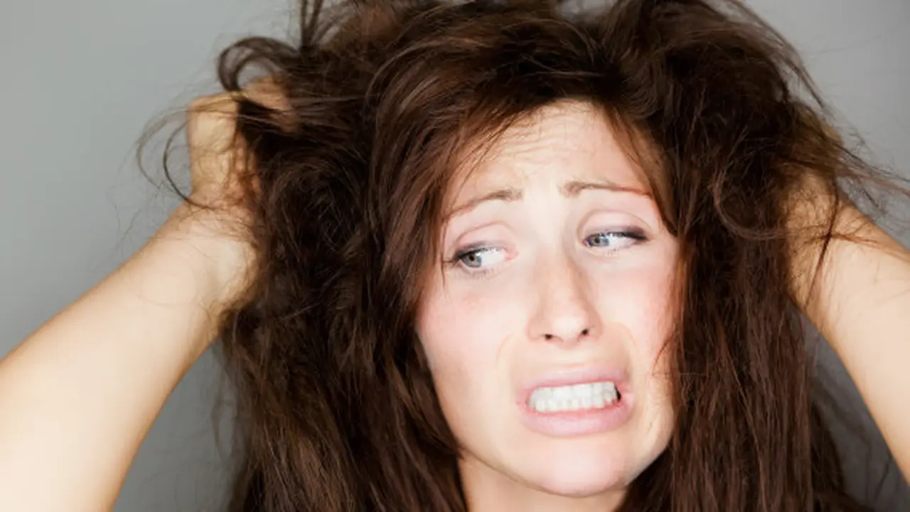 Tips Praktis Hilangkan Ketombe dari Rambut