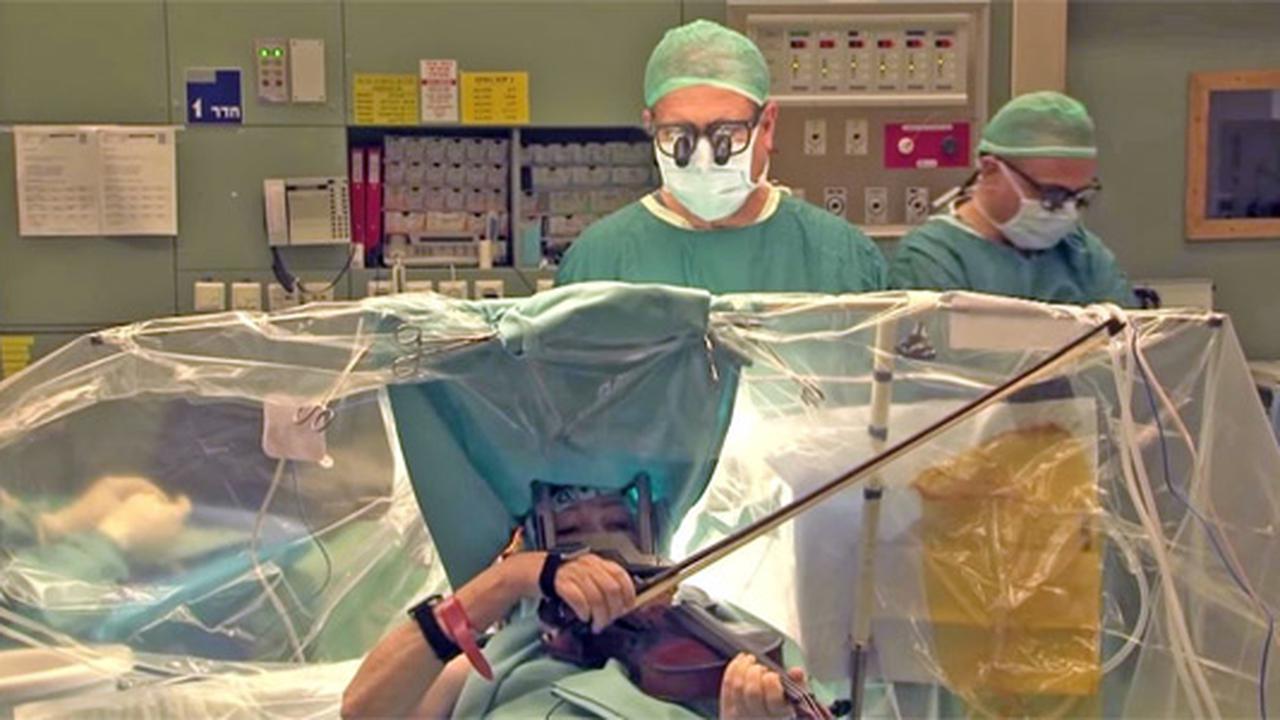 Bermain bola saat operasi otak. (Youtube)