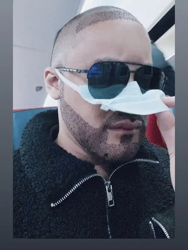 Potret Kevin Aprilio Jalani Transplantasi Rambut. (Sumber: Instagram/kevinaprilio)