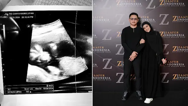 Potret Nadya Mustika Umumkan Hamil Anak Pertama Iqbal Rosadi, Penuh Bahagia