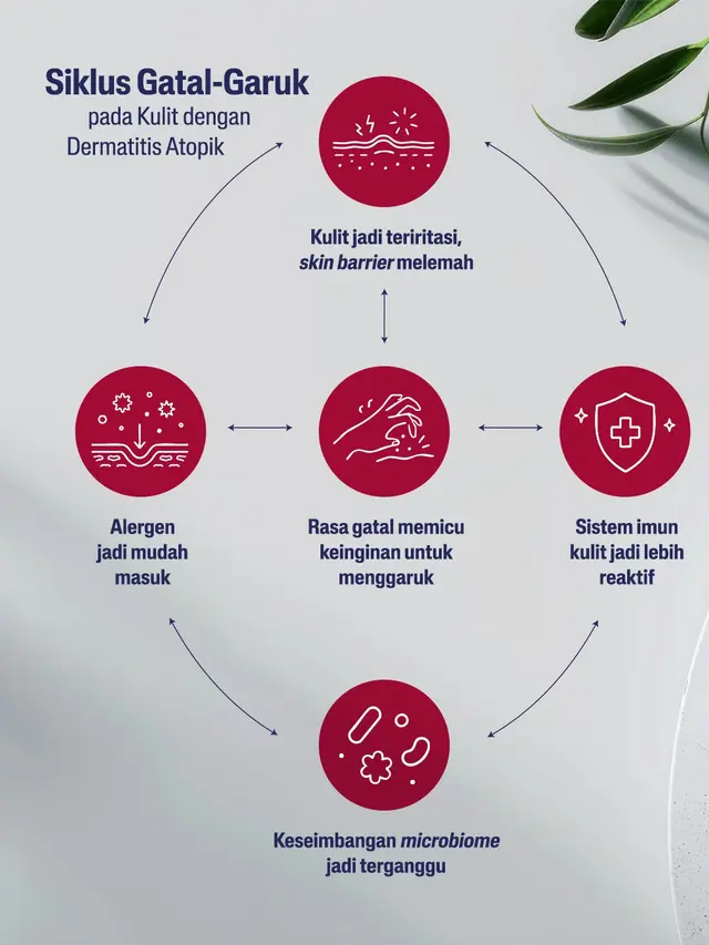 Kulit eksim