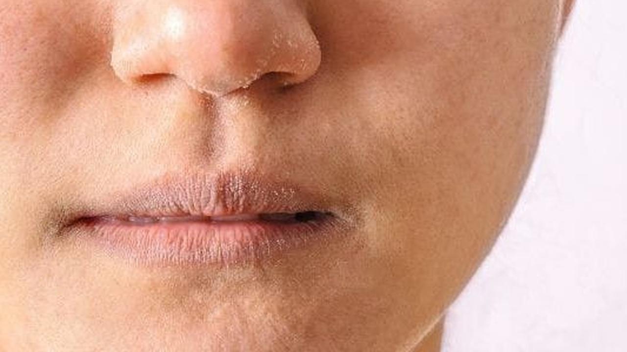 5 Rekomendasi Krim Malam Terbaik untuk Kulit Kering
