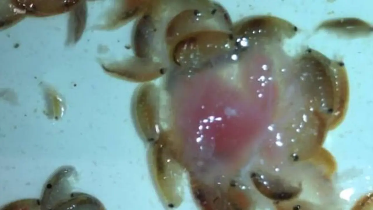 Makhluk misterius pemakan daging kaki seorang remaja di Melbourne, Australia. (Jarrod Kanizay)