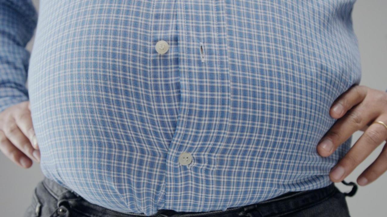 Cara Cerdas Mengatasi Obesitas: Menggabungkan Diet, Olahraga, dan Dukungan Psikologis