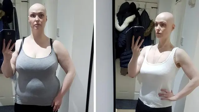 Gara-Gara Hapus Akun Media Sosial, Wanita Klaim Berat Badannya Turun hingga 30 Kg