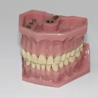 Mengenal Gingivitis atau Radang Gusi, Gejala, Penyebab, hingga Penanganannya. Image by Reto Gerber from Pixabay