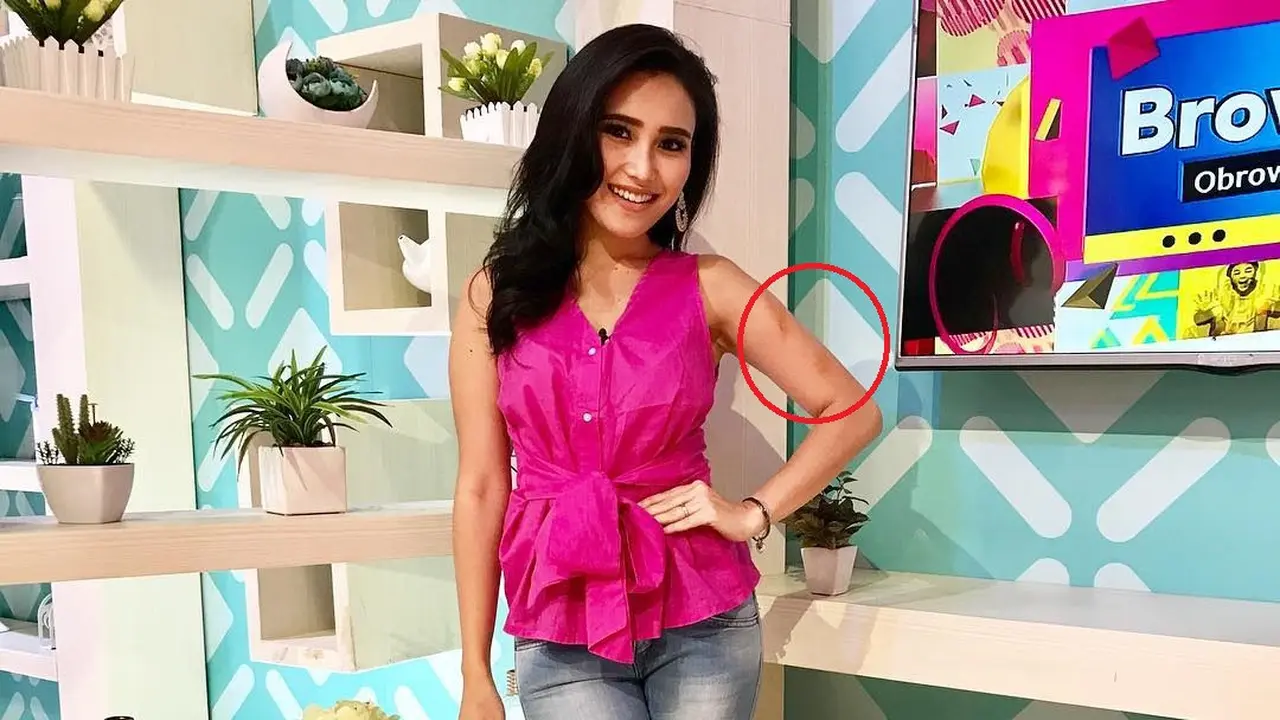 Ayu Ting Ting
