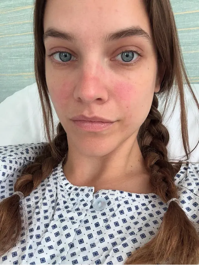 Endometriosis yang Terjadi pada Perempuan seperti Barbara Palvin. [@realbarbarapalvin]