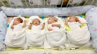 Rekor, Wanita 65 Tahun Melahirkan Bayi Kembar 4