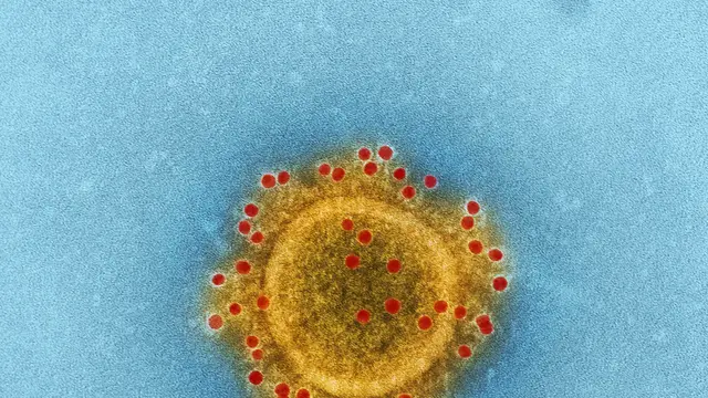 Ilustrasi Amoeba Pemakan Otak