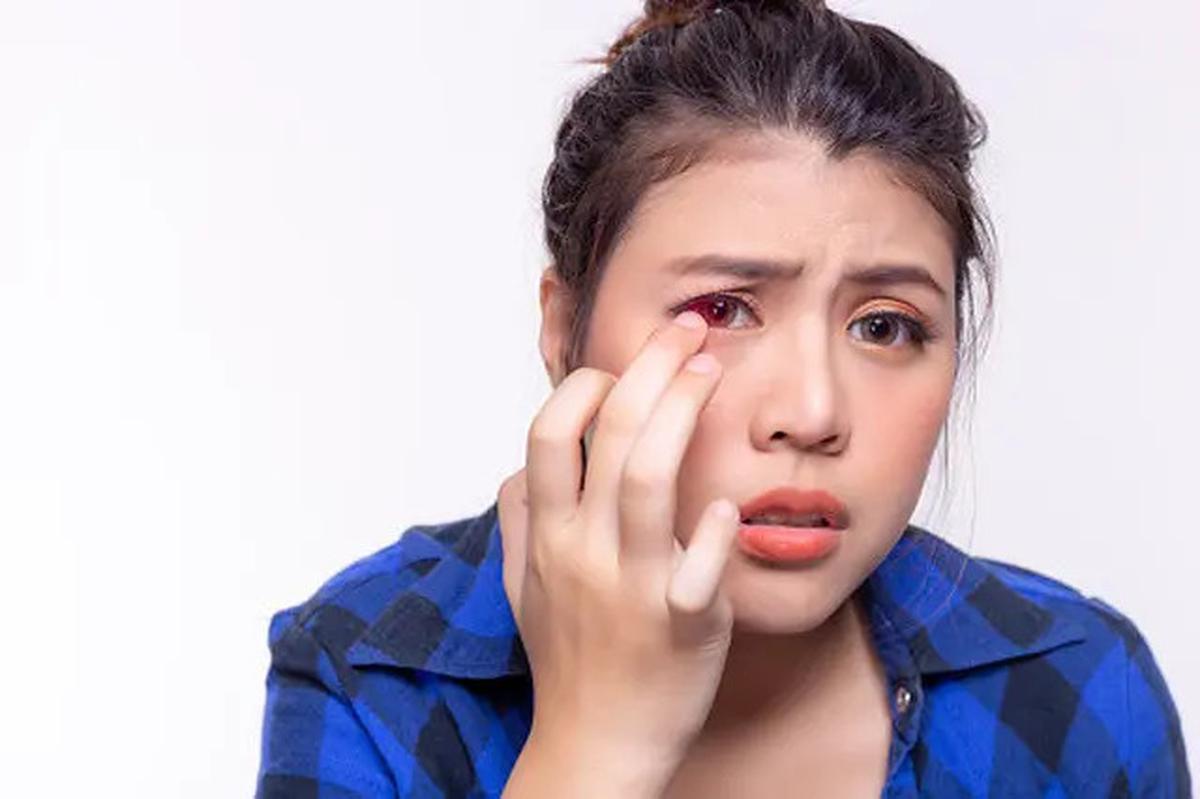 Jangan Anggap Remeh, Sakit di Mata Bisa Jadi Gejala Stroke