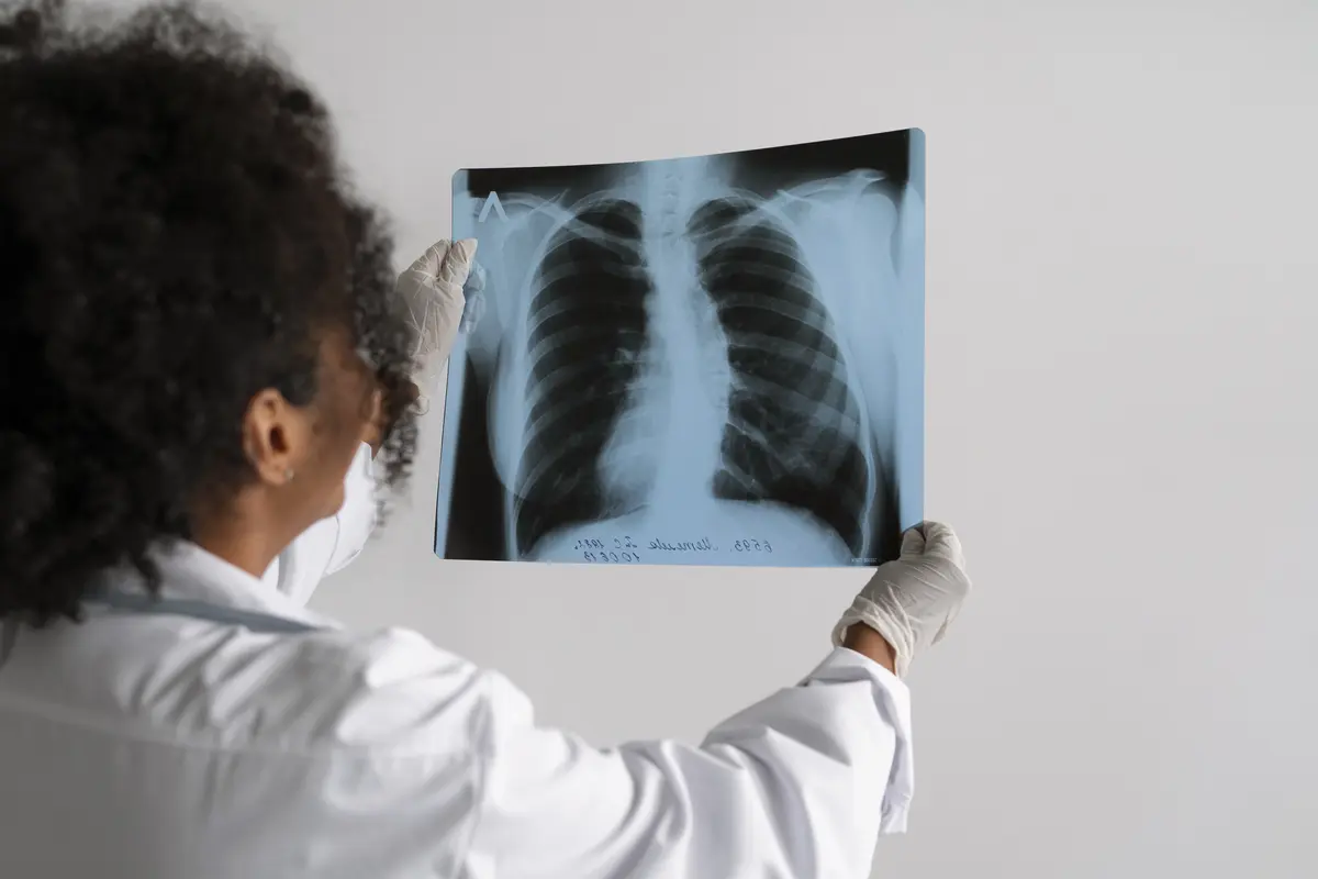 Seorang dokter sedang melihat hasil rontgen paru-paru (Foto Dok: Freepik/freepik)