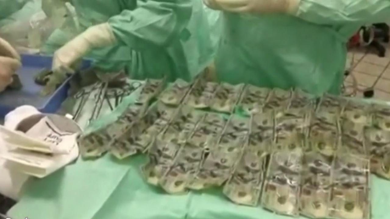 Bertengkar dengan Suami, Wanita Ini Telan Uang Kertas Rp 93 Juta