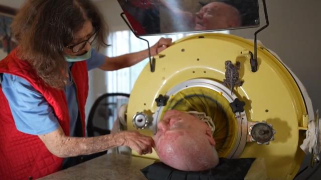 Kisah Polio Paul, 70 Tahun Bertahan Hidup Dengan Paru-paru Besi