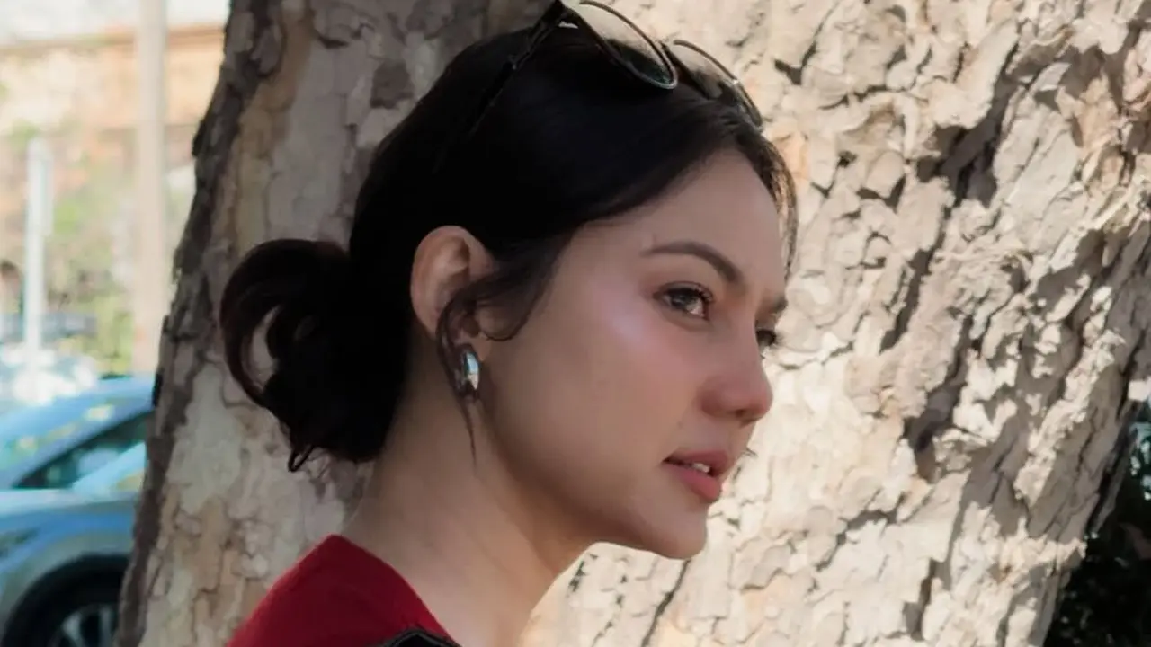Usai Oplas, Pesona Baru Rina Nose Disebut Bak Bule Saat Liburan di Melbourne