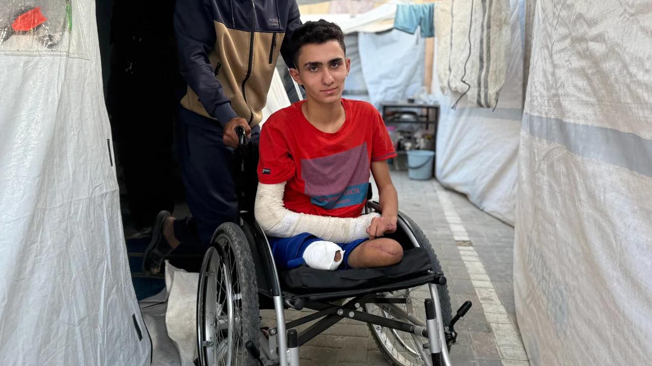 Aku Melihat Langsung Kaki dan Jariku Diamputasi,' Serangan Israel Hancurkan Mimpi Remaja Gaza
