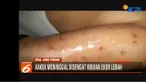Saat kejadian sang kakek tengah membentulkan letak genteng rumah. Namun tanpa diduga ribuan ekor lebah di atap rumah langsung menyerangnya.