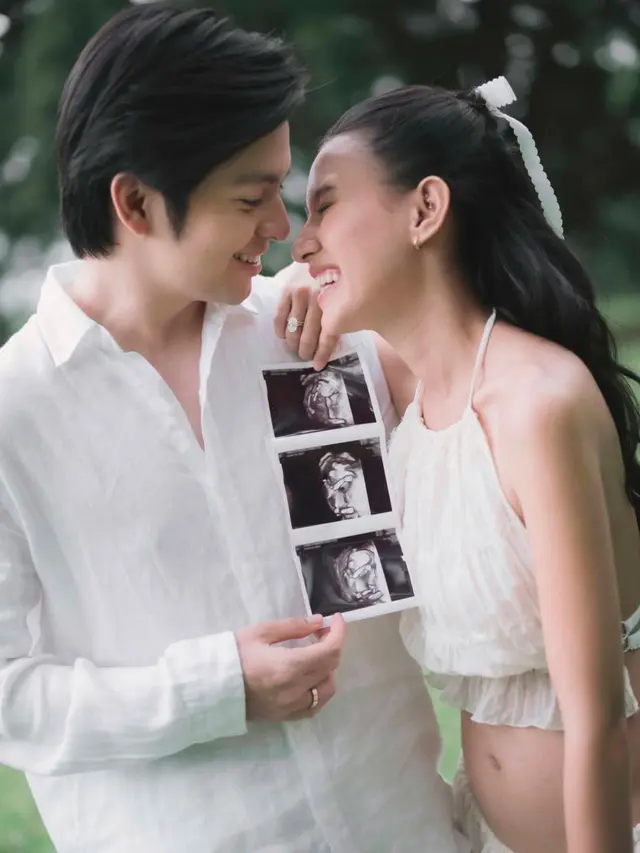 Shenina Cinnamon dan Angga pamer foto USG Anak Pertama. [@angga]