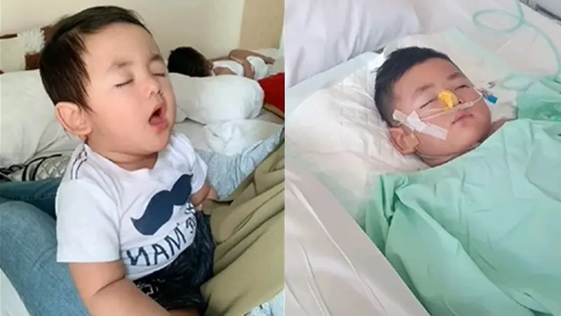 Bayi Shaka yang Viral Tertidru Selama 1 Tahun Meninggal Dunia