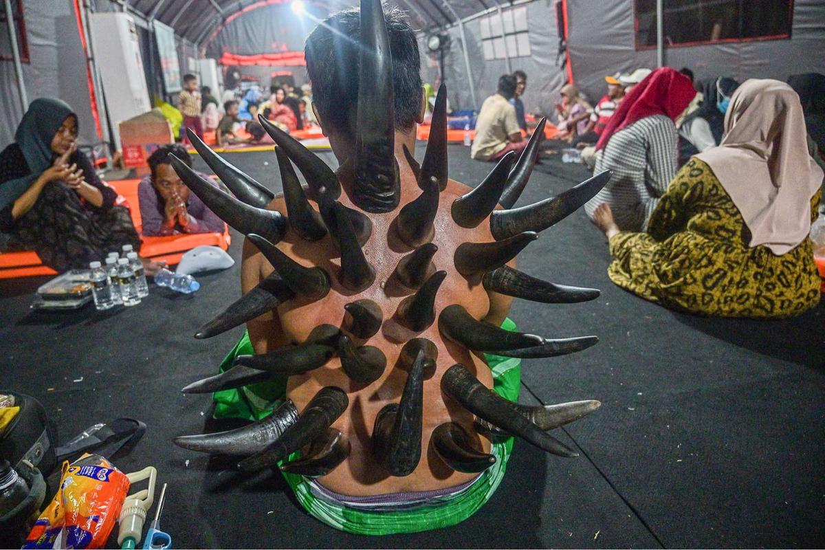 FOTO: Terapi Bekam Tanduk Sapi, Pilihan Lawas di Zaman Modern