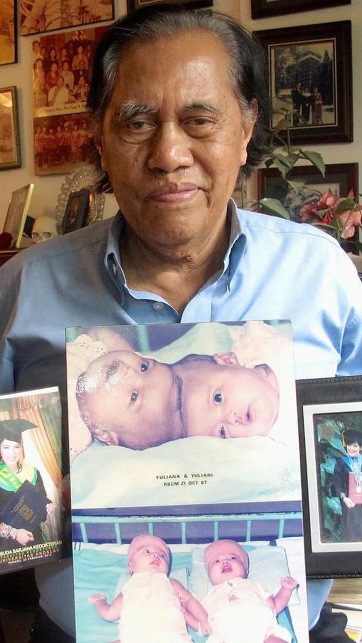 Dokter Padmo membawa foto Ana dan Ani sebelum operasi pemisahan kepala dilakukan